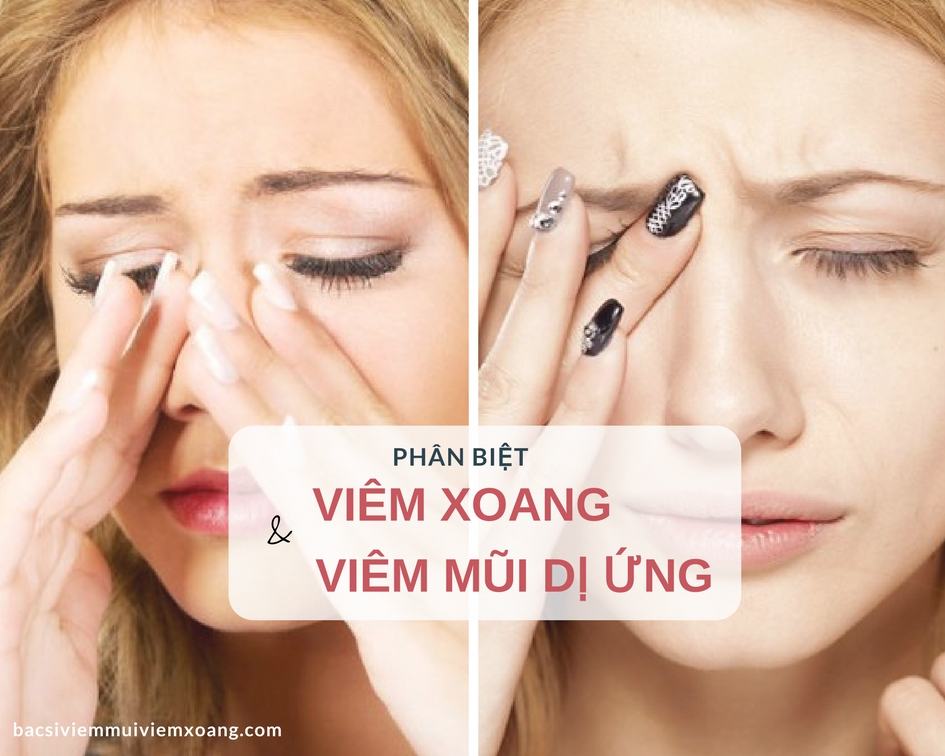 Viêm mũi dị ứng khác viêm xoang
