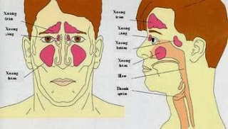 CÁCH CHỮA BỆNH LỆCH VÁCH NGĂN MŨI
