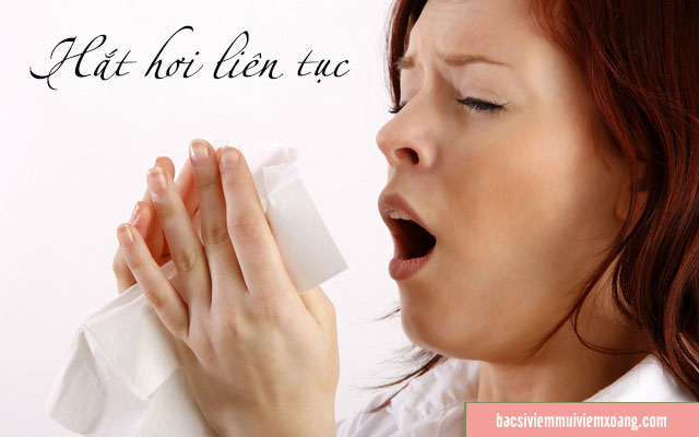 Hắt xì - Biểu hiện viêm mũi vận mạch Hắt xì - Biểu hiện viêm mũi vận mạch