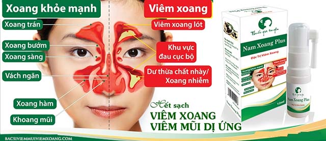 Thuốc gia truyền Nam Xoang Plus trị viêm xoang tốt không?