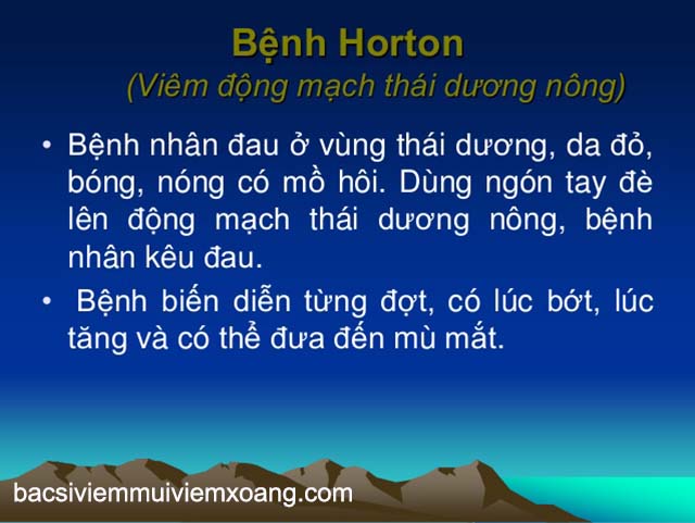 Đau đầu ở thái dương do bệnh Horton