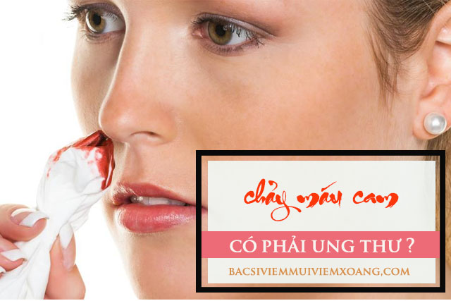 Chảy máu cam có bị ung thư không?