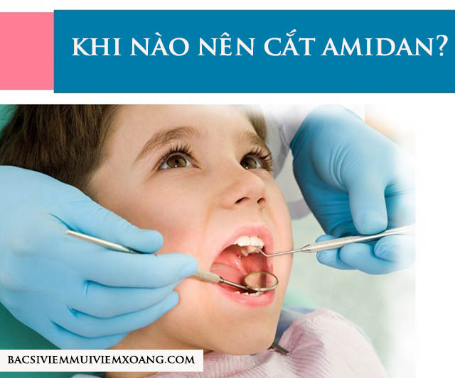 Khi nào nên cắt amidan - nên cắt amidan khi nào