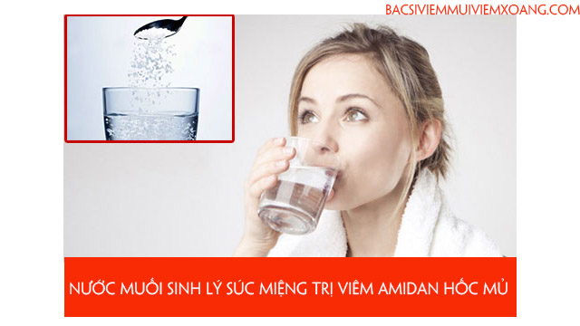 Vậy viêm amidan hốc mủ có lây không?