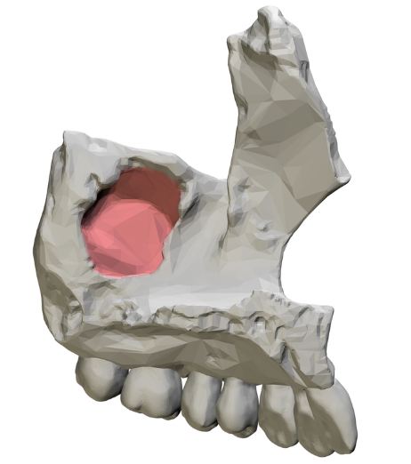 Cấu trúc và vị trí xoang hàm trong xương hàm và hộp sọ