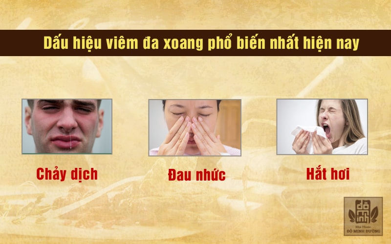 Dấu hiệu viêm đa xoang phổ biến nhất hiện nay