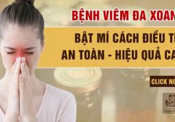 Bật mí cách điều trị đa viêm xoang cấp, mãn tính an toàn, hiệu quả cao