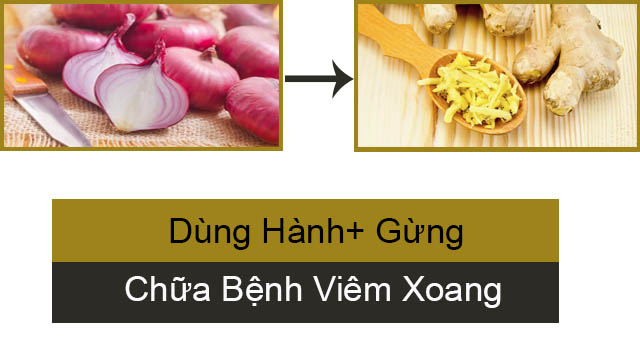 Hành và gừng chữa Viem mui xoang Hành và gừng chữa viêm xoang