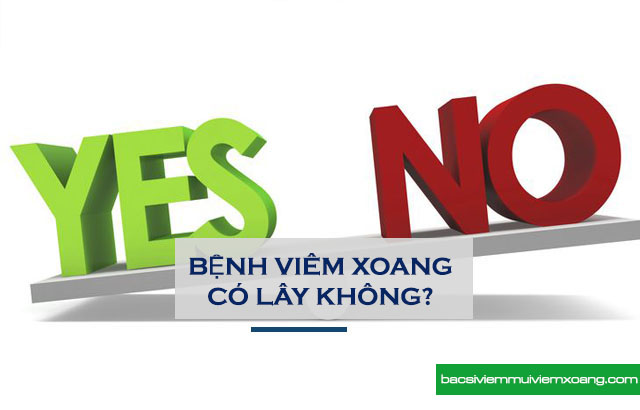 Bệnh viêm xoang có lây không và lây qua đường nào? - viêm xoang có bị lây hay không