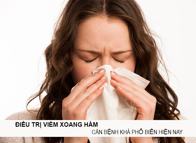 Viem xoang ham Viêm xoang hàm