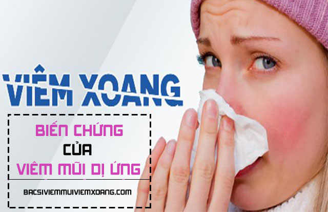 Viêm xoang - Biến chứng của bệnh viêm mũi dị ứng