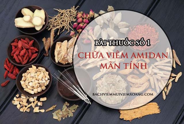 Bài thuốc số 1: Chữa viêm amidan mãn tính bằng đông y