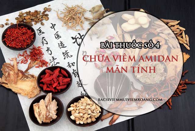 Bài thuốc số 4: Chữa viêm amidan mãn tính bằng đông y