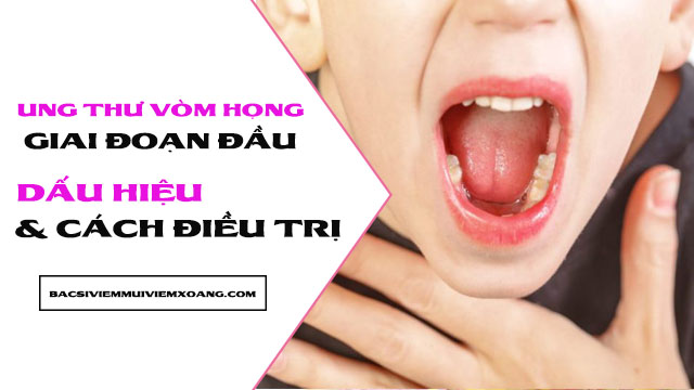 Ung thư vòm họng giai đoạn đầu và cách điều trị - biểu hiện ung thư vòm họng giai đoạn 1