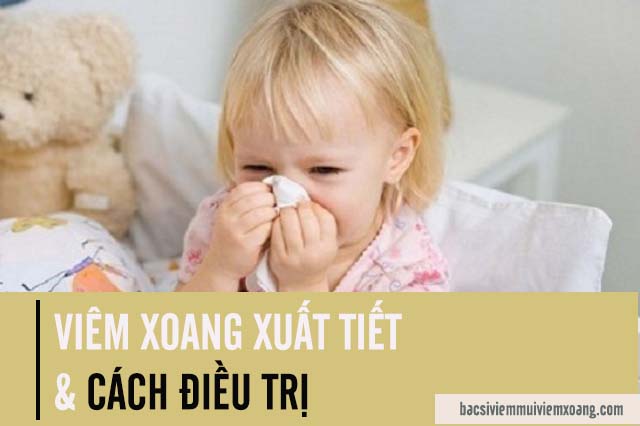 Viêm xoang xuất tiết và cách điều trị