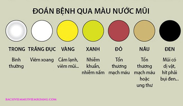 Nước mũi có màu vàng là bệnh gì? tìm hiểu về nước mũi màu vàng