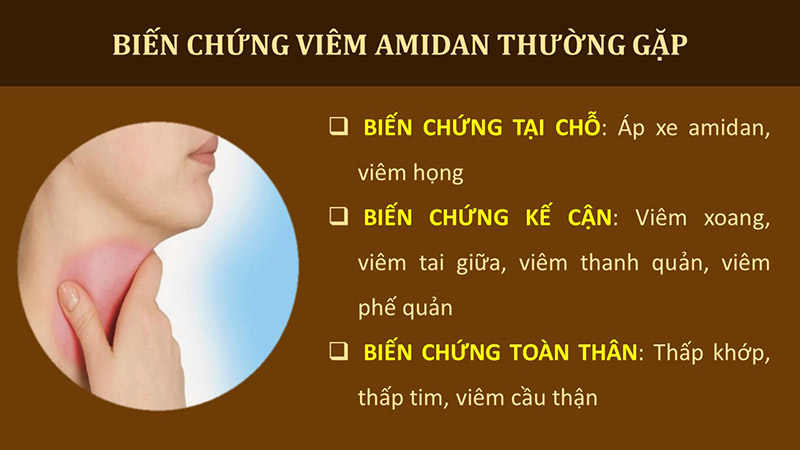 Biến chứng viêm amidan thường gặp Viêm amidan có nguy hiểm không