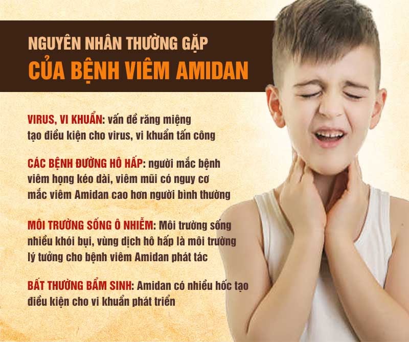 Có nhiều nguyên nhân gây viêm amidan