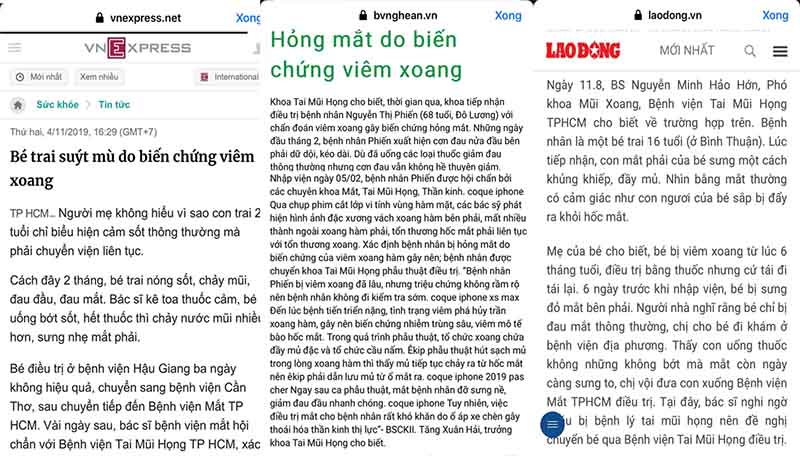 Nhiễm trùng mắt là biến chứng dễ gặp ở người bệnh viêm xoang